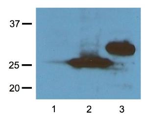 Anti-RFP Mouse Monoclonal Antibody [clone: RF5R]