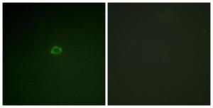 Immunofluorescence analysis of A549 cells using Anti-4E-BP1 Antibody The right hand panel represents a negative control, where the antibody was pre-incubated with the immunising peptide