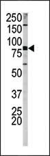 Anti-APP Rabbit Polyclonal Antibody