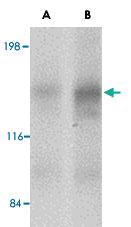 Anti-CADPS2 Rabbit Polyclonal Antibody