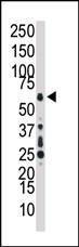 Anti-MAP3K7 Rabbit Polyclonal Antibody (PE (Phycoerythrin))