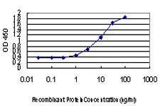 Anti-DLX2 Mouse Monoclonal Antibody [clone: 2C8]