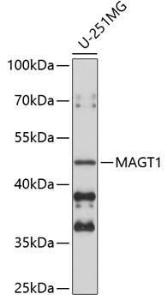 Western blot analysis of extracts of U-251MG cells, using Anti-MAGT1 Antibody (A9635) at 1:1,000 dilution. The secondary antibody was Goat Anti-Rabbit IgG H&L Antibody (HRP) at 1:10,000 dilution.