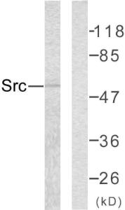 Western blot analysis of lysates from COLO205 cells using Anti-Src Antibody. The right hand lane represents a negative control, where the antibody is blocked by the immunising peptide.