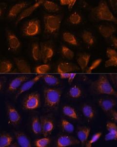 Immunofluorescence analysis of U-2 OS cells using Anti-SHMT1 Antibody (A93321) at a dilution of 1:100. DAPI was used to stain the cell nuclei (blue).