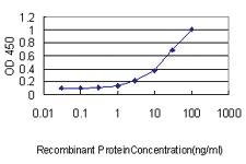 Anti-SERPINH1 Mouse Monoclonal Antibody [clone: 1D2-1A6]