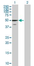 Anti-GFAP Mouse Polyclonal Antibody