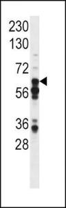 Anti-STAT3 Rabbit Polyclonal Antibody (PE (Phycoerythrin))