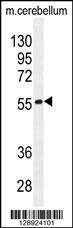 Anti-FAM69B Rabbit Polyclonal Antibody (HRP (Horseradish Peroxidase))