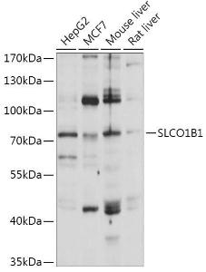 Western blot analysis of extracts of various cell lines, using Anti-OATP1B1 Antibody (A93322) at 1:1000 dilution. The secondary Antibody was Goat Anti-Rabbit IgG H&L Antibody (HRP) at 1:10000 dilution. Lysates/proteins were present at 25 µg per lane