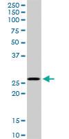 Anti-MSX1 Rabbit Polyclonal Antibody