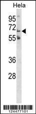 Anti-GLT11 Rabbit Polyclonal Antibody (AP (Alkaline Phosphatase))