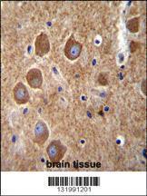 Anti-PAK6 Rabbit Polyclonal Antibody (FITC (Fluorescein Isothiocyanate))