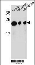 Anti-ATP5H Rabbit Polyclonal Antibody (Biotin)