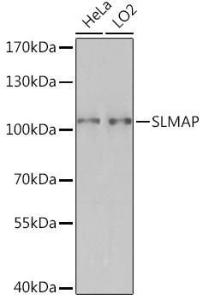 Anti-SLMAP antibody