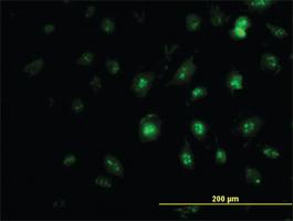 Anti-ZIC4 Mouse Monoclonal Antibody [clone: 3D5]