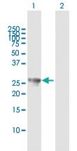 Anti-PSMA8 Rabbit Polyclonal Antibody