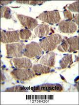 Anti-GSAP Rabbit Polyclonal Antibody (AP (Alkaline Phosphatase))