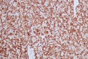 Immunohistochemical analysis of formalin-fixed, paraffin-embedded dog pancreas using Anti-HSP60 Antibody [HSPD1/2206R]