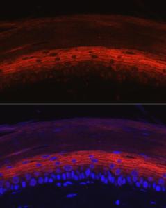 Immunofluorescence analysis of rat skin using Anti-K80 Antibody (A9668) at a dilution of 1:50 (40x lens) DAPI was used to stain the cell nuclei (blue)