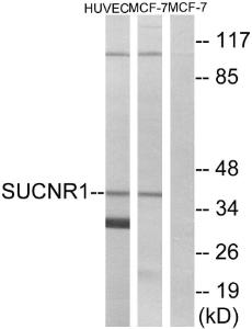 Western blot analysis of lysates from HUVEC and MCF-7 cells using Anti-SUCNR1 Antibody The right hand lane represents a negative control, where the antibody is blocked by the immunising peptide