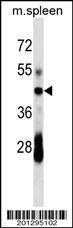 Anti-CD79A Mouse Monoclonal Antibody (FITC (Fluorescein Isothiocyanate)) [clone: 299CT22.1.2]