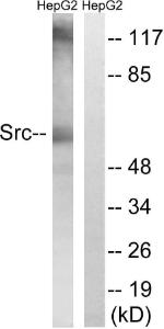 Western blot analysis of lysates from HepG2 cells using Anti-Src Antibody. The right hand lane represents a negative control, where the Antibody is blocked by the immunising peptide