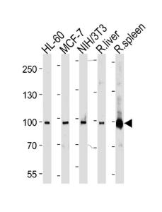 Anti-Stat 5b Rabbit Polyclonal Antibody (FITC (Fluorescein))