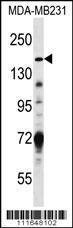 Anti-TSC1 Rabbit Polyclonal Antibody