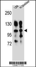 Anti-ITGA5 Rabbit Polyclonal Antibody (FITC (Fluorescein Isothiocyanate))