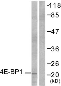 Anti-eIF4EBP1 Rabbit Polyclonal Antibody