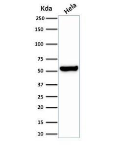 Western blot analysis of HeLa cell lysate using Anti-HSP60 Antibody [HSPD1/2206R]