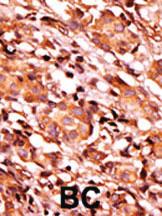 Anti-BAD Rabbit Polyclonal Antibody