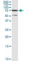 Anti-CFLAR Polyclonal Antibody Pair