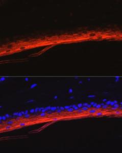 Immunofluorescence analysis of mouse skin using Anti-K80 Antibody (A9668) at a dilution of 1:50 (40x lens) DAPI was used to stain the cell nuclei (blue)