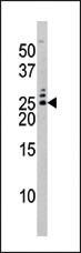 Anti-BAD Rabbit Polyclonal Antibody