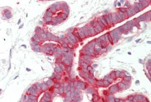 Anti-Cytokeratin 18 Antibody (A83652) (5 µg/ml) staining of paraffin embedded Human Breast. Steamed antigen retrieval with citrate buffer pH 6, AP-staining