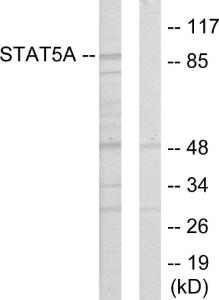 Western blot analysis of lysates from 293 cells using Anti-STAT5A Antibody. The right hand lane represents a negative control, where the Antibody is blocked by the immunising peptide