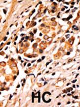 Anti-BAD Rabbit Polyclonal Antibody