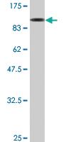 Anti-EDC3 Mouse Monoclonal Antibody [clone: 4E3-3A4]