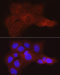 Immunofluorescence analysis of A431 cells using Anti-K80 Antibody (A9668) at a dilution of 1:50 (40x lens) DAPI was used to stain the cell nuclei (blue)