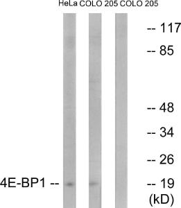 Western blot analysis of lysates from HeLa and COLO205 cells, treated with EGF 200 ng/ml 5' using Anti-4E-BP1 Antibody. The right hand lane represents a negative control, where the Antibody is blocked by the immunising peptide