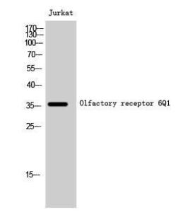 Western blot analysis of Jurkat cells using Anti-OR6Q1 Antibody