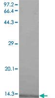 Anti-CXCL1 Mouse Monoclonal Antibody [clone: 5f252]