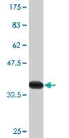 Anti-S100 A8 Mouse Monoclonal Antibody [clone: 1B3]