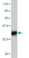 Anti-PTCH1 Mouse Monoclonal Antibody [clone: 8E1]