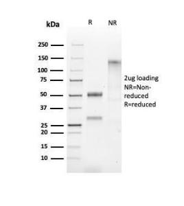 SDS-PAGE analysis of Anti-HSP60 Antibody [HSPD1/2206R] under non-reduced and reduced conditions; showing intact IgG and intact heavy and light chains, respectively. SDS-PAGE analysis confirms the integrity and purity of the antibody.