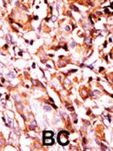 Anti-BAD Rabbit Polyclonal Antibody