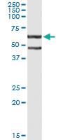 Anti-CFLAR Antibody Pair