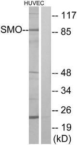 Western blot analysis of lysates from HUVEC cells using Anti-SMO Antibody. The right hand lane represents a negative control, where the Antibody is blocked by the immunising peptide